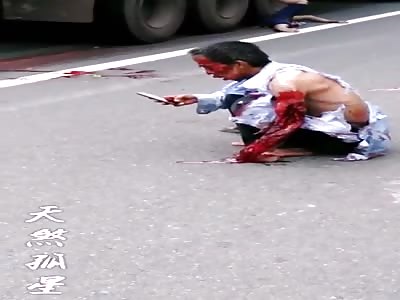 do not call the ambulance ... it's too late 