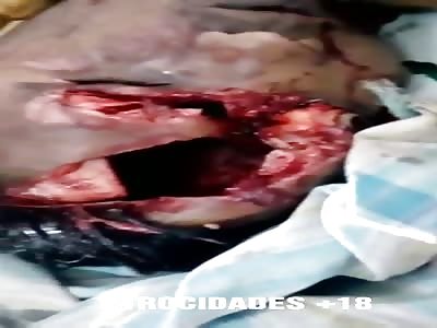 face disfigured by a rifle shot