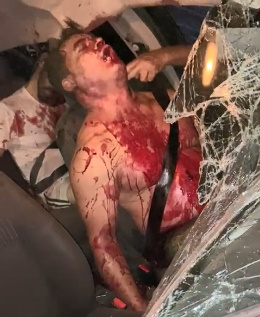 Guys Are Broken After Night Road Accident