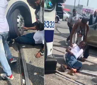Man Got Both Legs Fucked Up By SEPTA Bus
