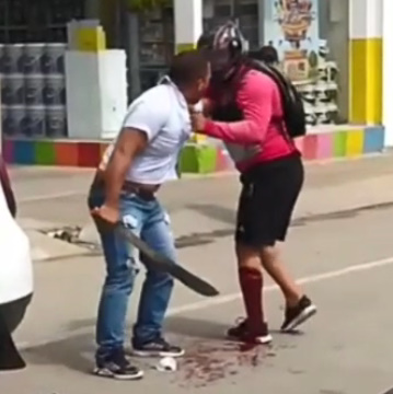 Road Rage Leaves Biker with a Huge Bleeding Machete Wound