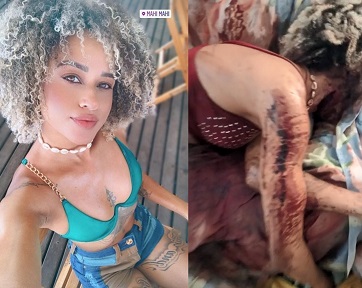 Throat Sliced by Her Boyfriend.