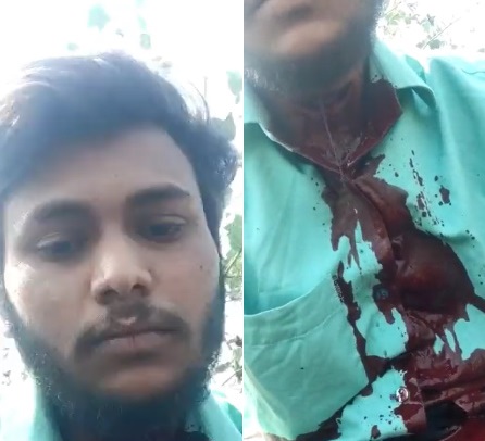 Horrible Selfie Of Man Bleeding To Death After Sliting Own Throat On Live Chat With Friends