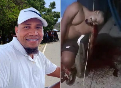 Man In Agony After Taking 2 Bullets At Close Range