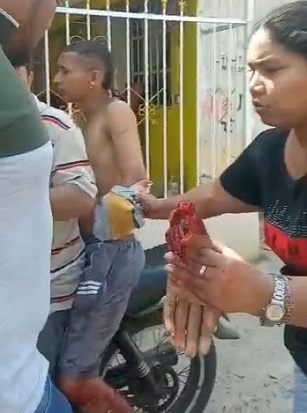 A Man Has His Hand Sliced Off Like a Piece of Ham