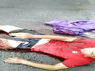 shocking man loses his leg in accident