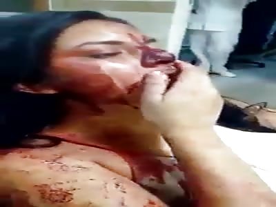 Woman was beaten by her husband
