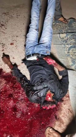 DAMN: Literally Ripped His Head Off