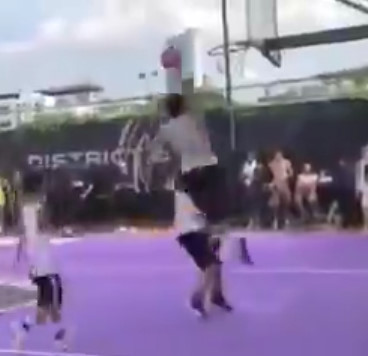 OMG! This Guy's Ankle