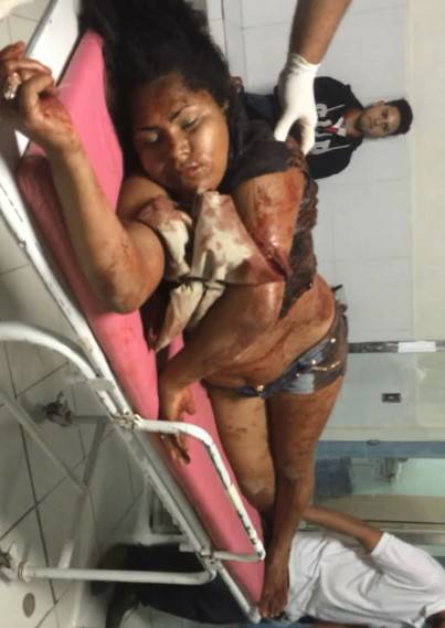 Woman Agonizing after Being Stabbed by Ex boyfriend