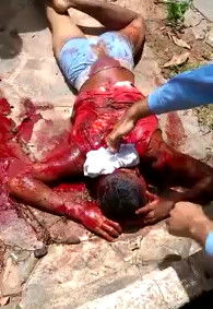 Stabbed man mourns in pain waiting for an ambulance