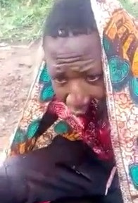 Dude Hacked Up by Machete is a MESS