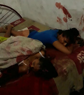 Homicide: Girl murdered and her mother injured by thieves