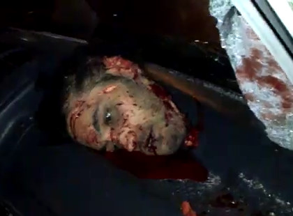 Just a Headless Man after accident