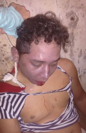 Prisoner from Brazil Gets Choked to Death by His Peers