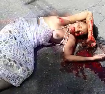 AGONY AFTER NEW YEAR: Young Girl Lands with Tits Out After Brutal Accident