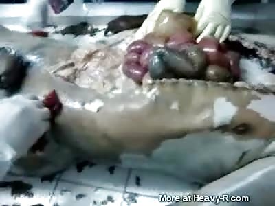 autopsy doctors laugh