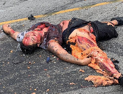 Poor Girl... New Brutal Accident Leaves Carnage on the Ground