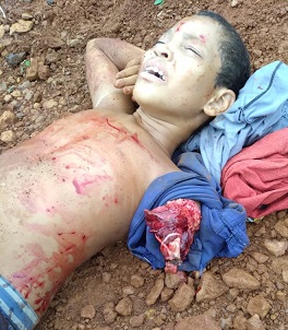 Poor Kid with Arm Ripped Clean Off Is In a Complete State of Shock