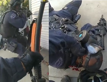 SWAT Cop Gets Shot in Face During Police Shootout With Suspect in Los Angeles, California