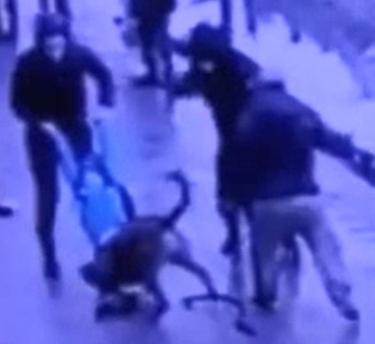 School Boy Attacked By Huge Dog In Kyrgyzstan