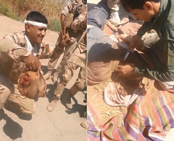 They Call this a Trophy