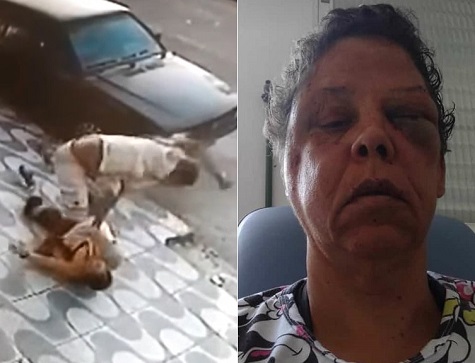 Woman Resists Robbery and Almost Loses Her Eyesight