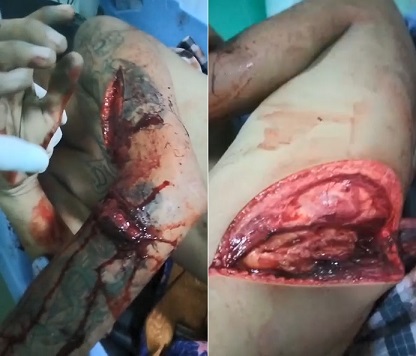 Gang Member Hacked By Rivals In Vicious Sword Fight In Indonesia