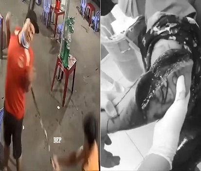 Don't Bring Your Arm To An Sword Fight 