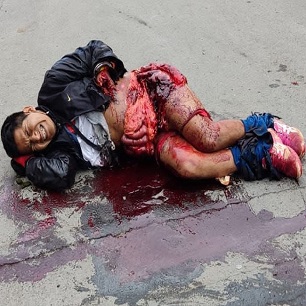 Protester Accidentally Detonates Himself With Own Dynamite (Action & Aftermath)