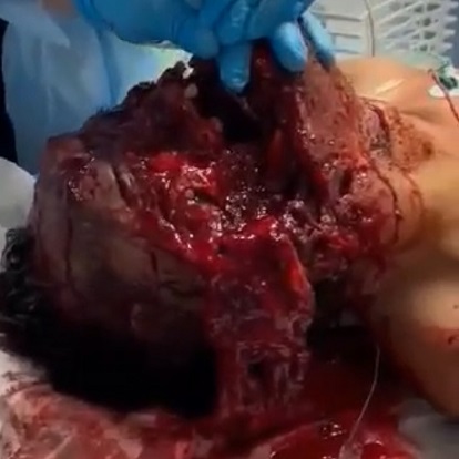 FUCK! There's No Reason This Man Should Be Alive