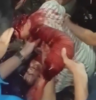 Lunatic Stabs Wife and Son to Bloody Mess