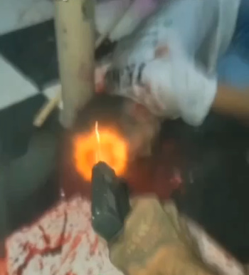 Screaming Trafficker Shoots Rival In The Head At Point Blank Range