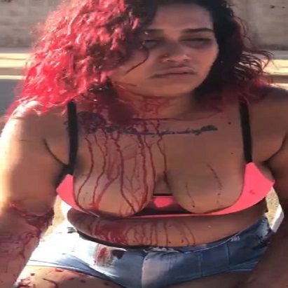 Reason Not To Bring Your Fists To A Machete Fight