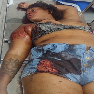 Couple Involved In Gang Dispute Pay The Price