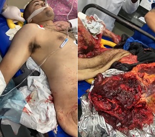 DAMN! Somehow This Dude Is Still Alive...