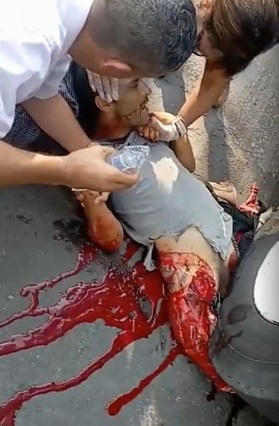 One of Those Times You Don't Want to be Alive