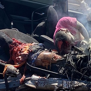 Couple Lost Battle With A Truck