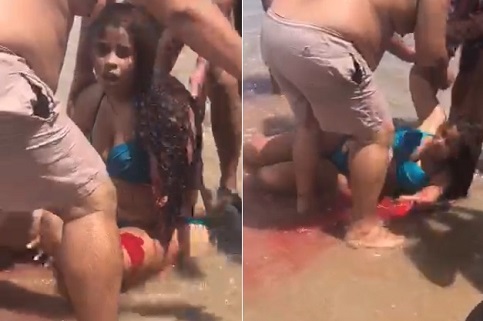 Shark Attack Survivor Is Gonna Need Stitches