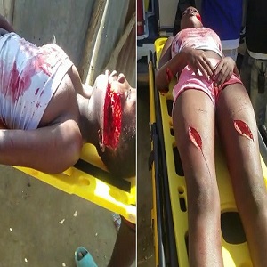 HOLY SHIT! Girl Hacked Up Like a Piece of Raw Pork 