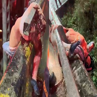 Somehow This Woman Is Still Alive...