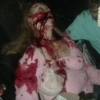 Woman Slowly Passes Away Following Crash In Mexico