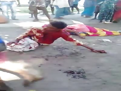 Man shot all fucked up dying 