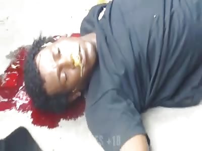 Dude shot in the head dying