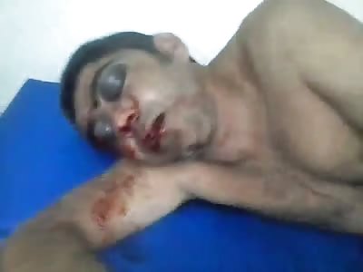 Injured guy at the hospital 