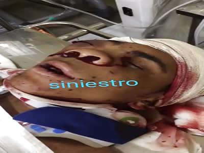 Injured guy in the hospital 