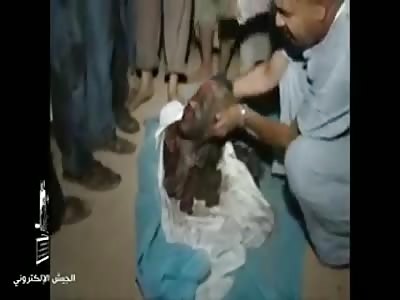 Body parts after bombing 