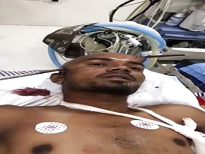 Iron Rod Through the FACE [Still Alive]