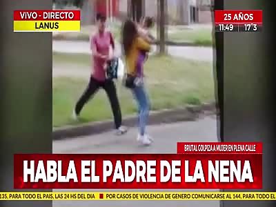 Brutally attacked woman