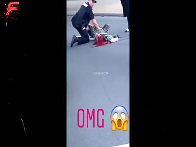 Motorcyclist Loses His Leg During Accident In Richmond, Virginia